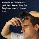 Derma Roller For Hair And Beard Regrowth, 540 Micro 0.5mm Titanium Alloy Needles Reduces Hair Fall & Stimulates Hair Follicles, For Men & Women