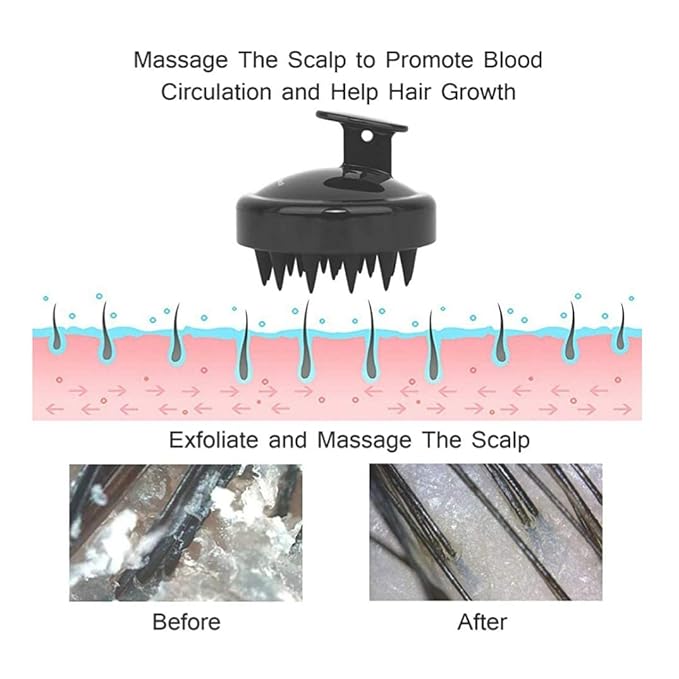 Hair Scalp Massager Shampoo Brush, Silicone Soft Bristles For Head Massaging and Washing, Anti-dandruff Removal Brush, Comb With Handle (Multicolor) (Black, Pack of 1) - Image 3